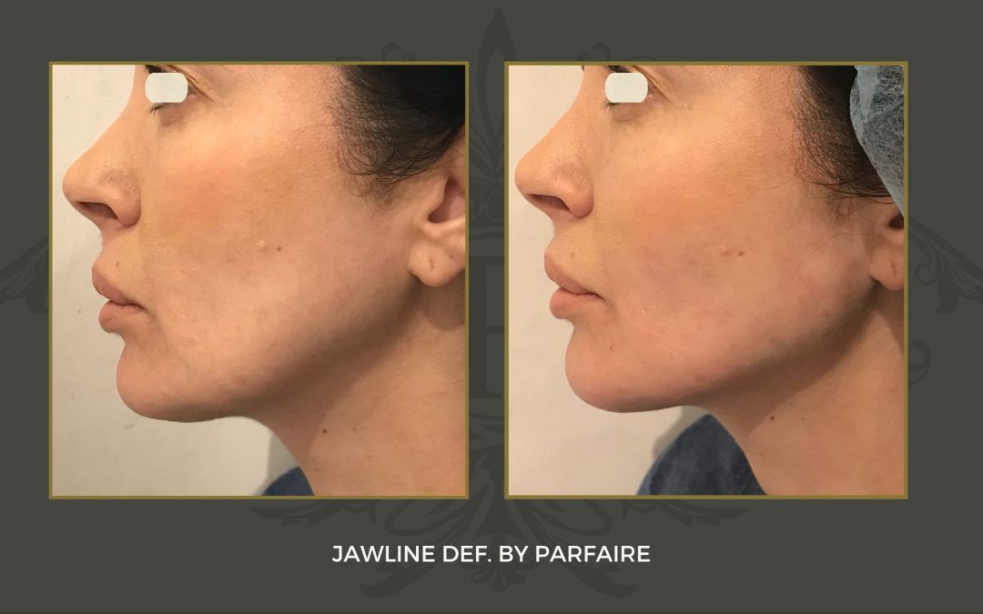 Jawline