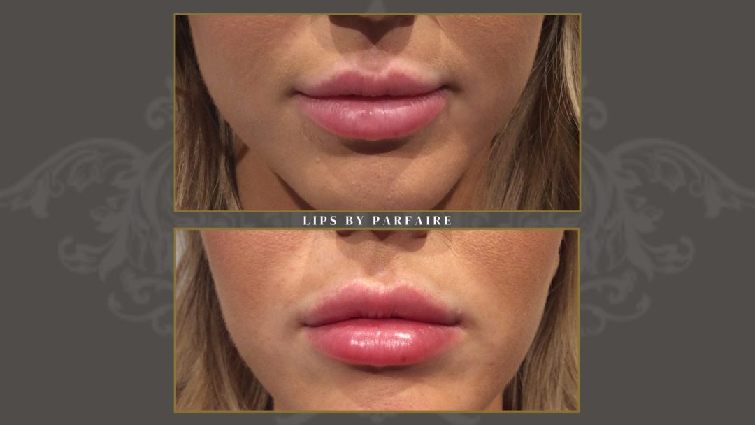 lips
