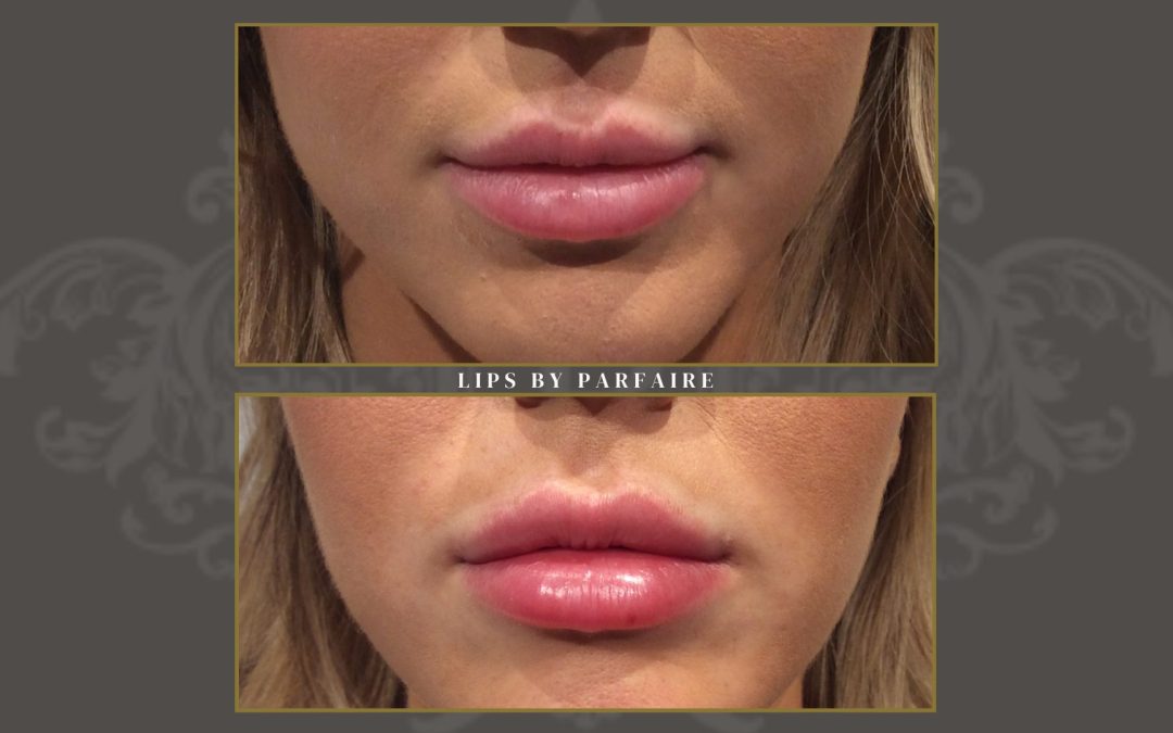 lips