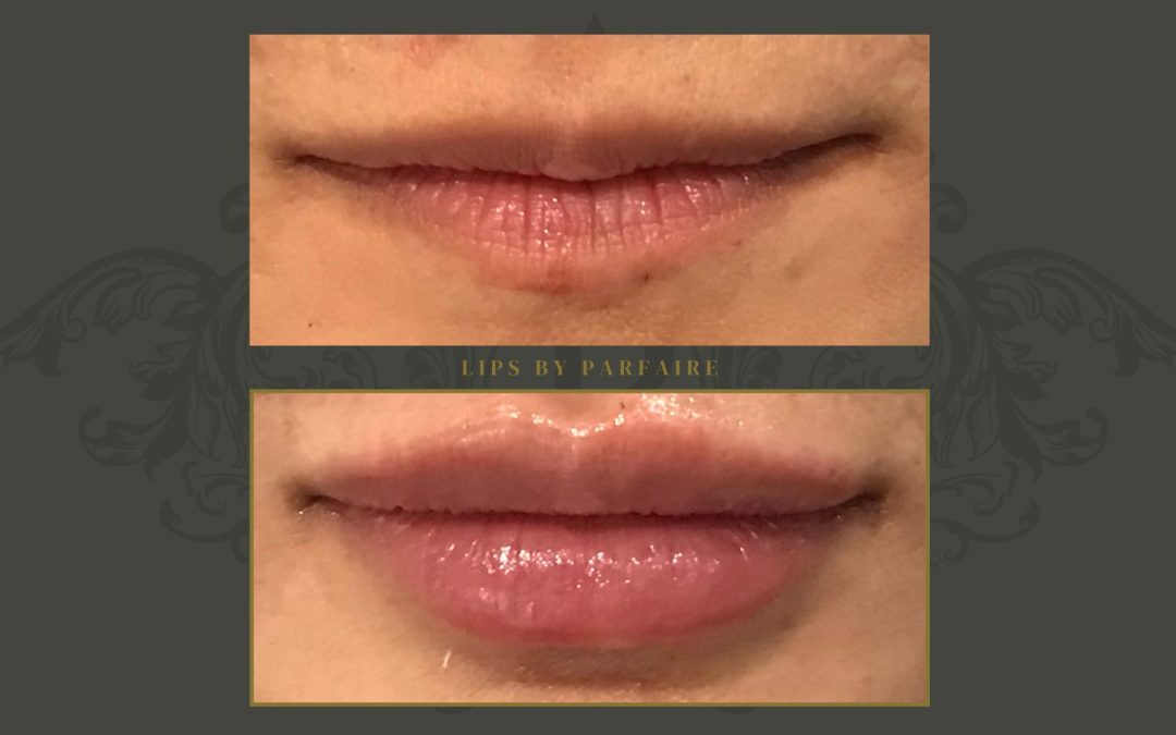 Lip