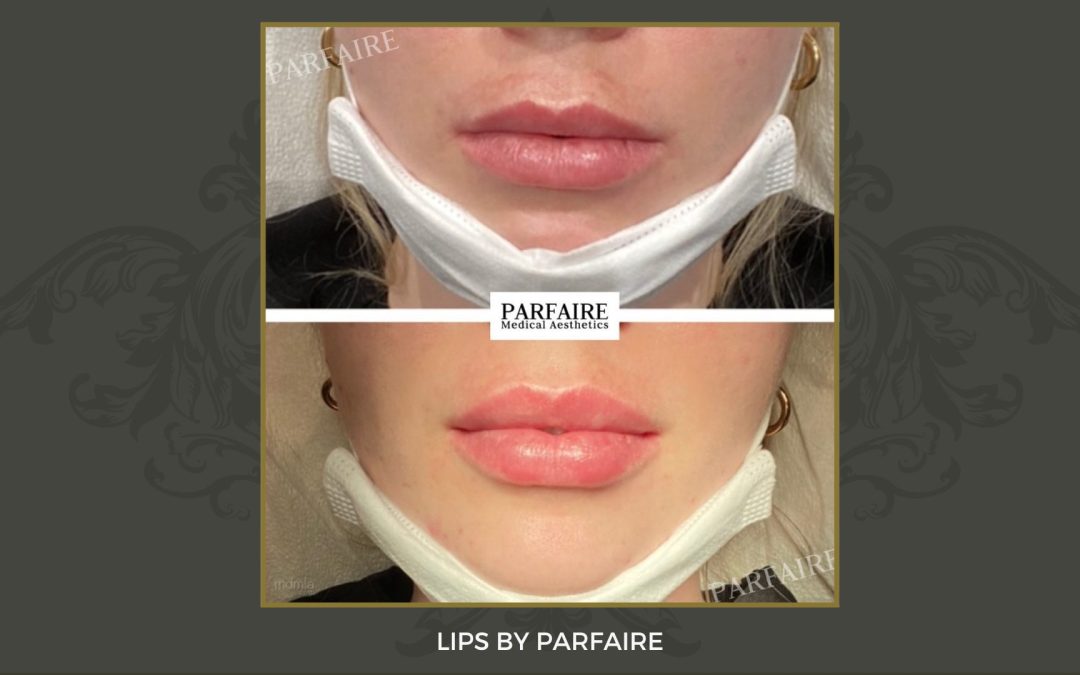 lips